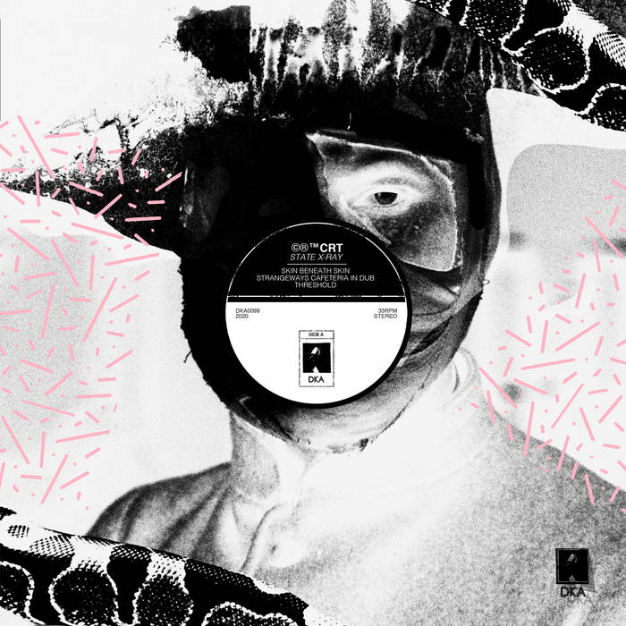 CRT - State X-Ray