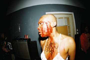 KT from Upchuck with blood on her face